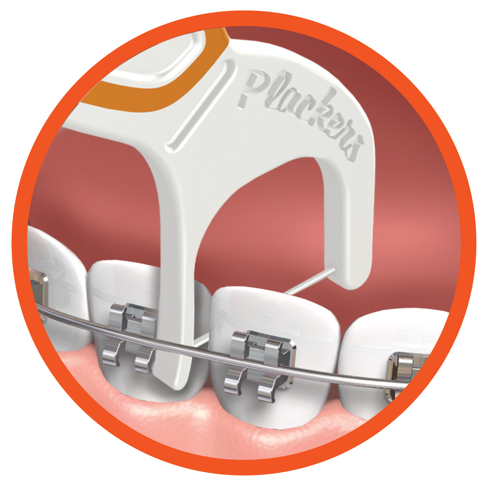 plackers ortopick зубная нить для чистки зубов с установленными  брекетами